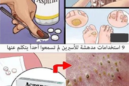 9 استخدامات مفيدة للأسبرين في حياتكم اليومية لم تخطر ببالكم قط !