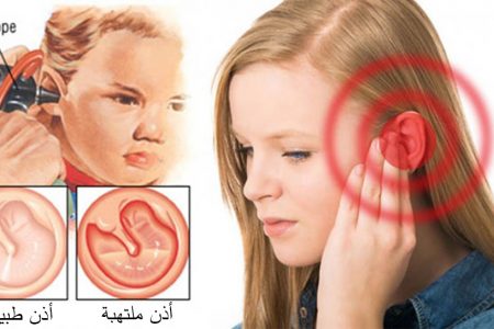 7 أعراض لتشخيص إصابتكم وإصابة أولادكم بالتهاب الأذن مع العلاجات الطبيعية
